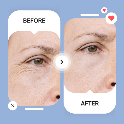 Micro-Infusion Patches