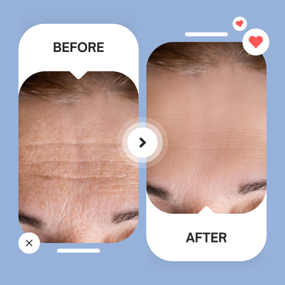 Micro-Infusion Patches