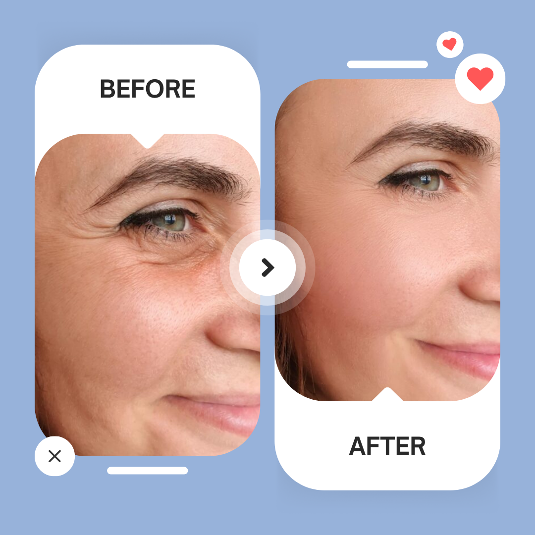 Micro-Infusion Patches